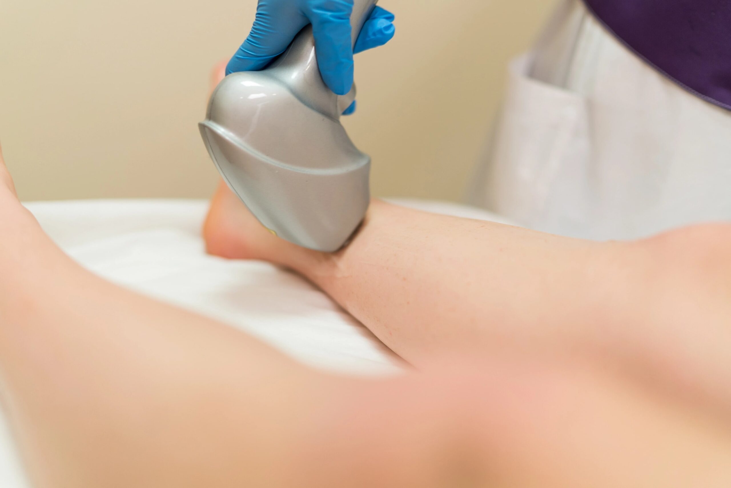 laser vein treatment on calf